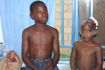Young victims of bomb blast in Kaduna.