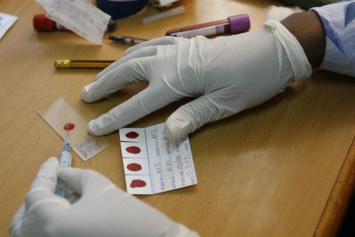 Blood samples being prepared for analysis as part of a malaria trial.