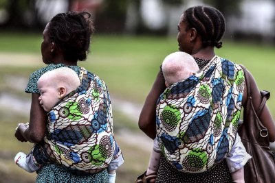 En Argentine, les albinos sont souvent victimes d'enlèvements à des fins de sorcellerie,.