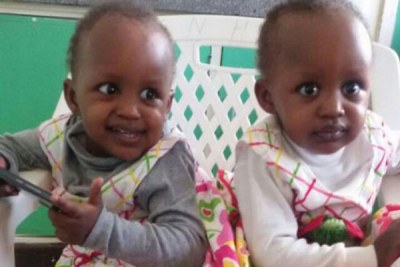 Twins, Blessing and Favour, before the surgery that separated them.