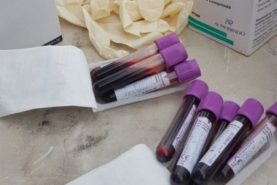 Blood samples to test viral load (file photo).