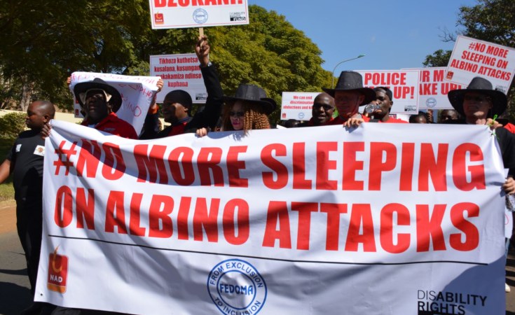 Malawi People With Albinism To Proceed With State House Vigils Allafrica Com