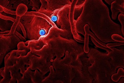 Particules de coronavirus MERS sur des cellules épithéliales de chameau.