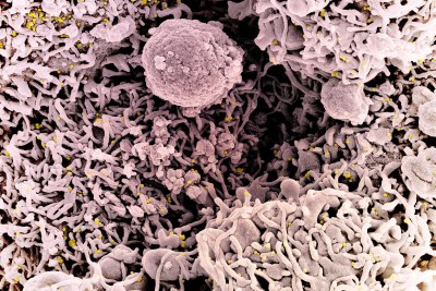 A colourised scanning electron micrograph of a cell (pink) infected with a variant strain of SARS-CoV-2 virus particles (file photo).